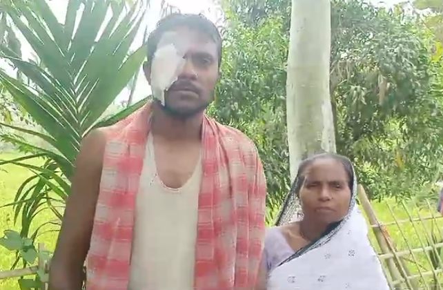 Voter Suffers Eye Injury In Poll Violence In Cooch Behar Sparks Concern Siliguri Times